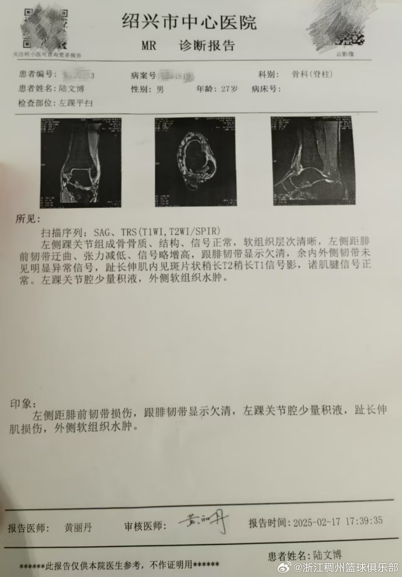 这支有着数